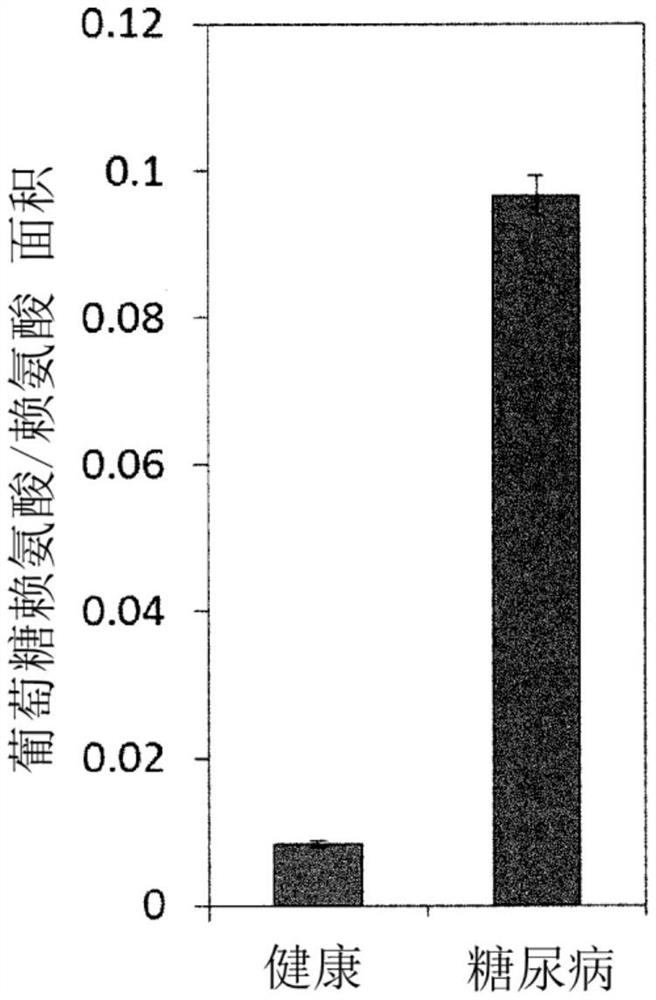 Marker for diabetic complications