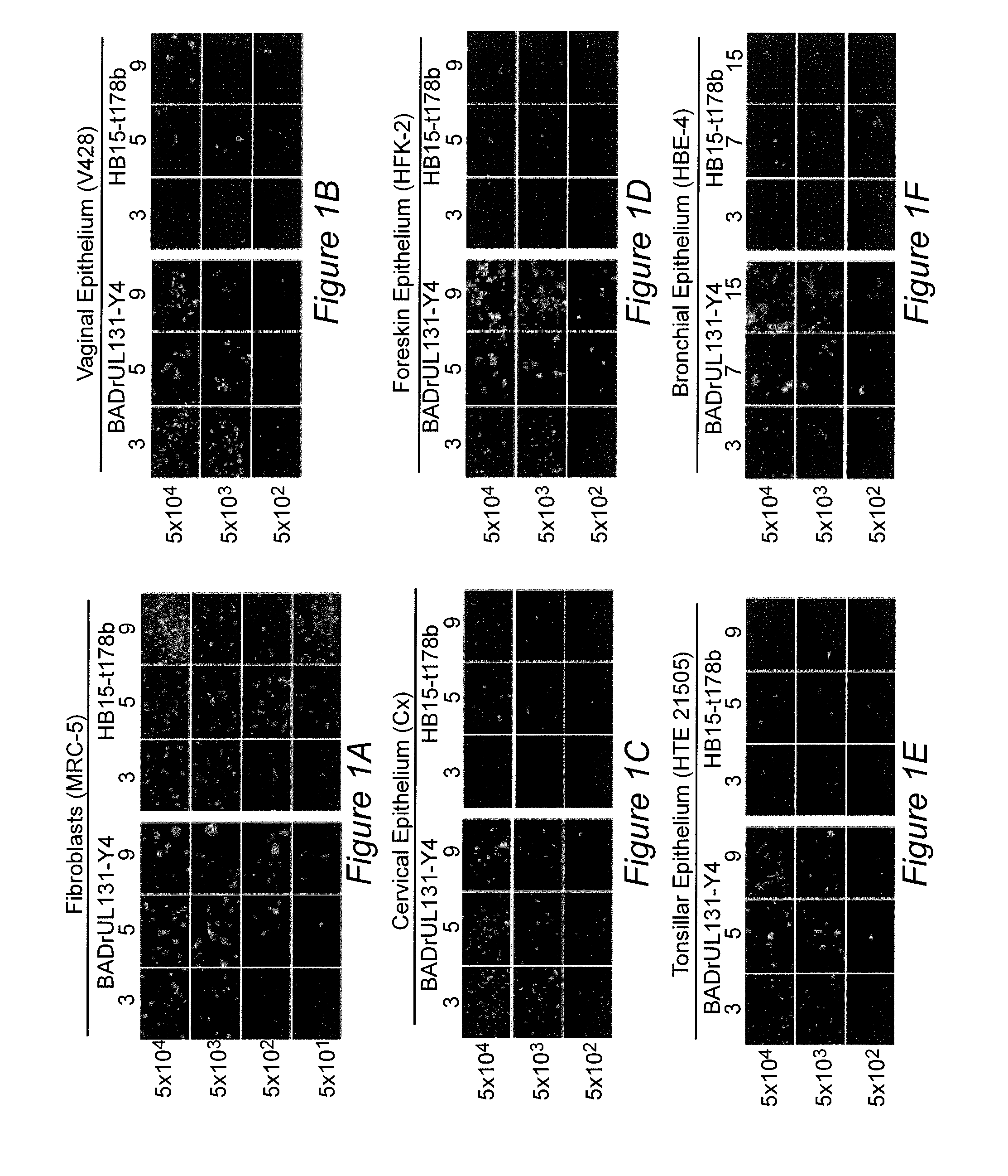 Human cytomegalovirus vaccine