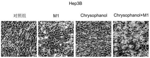 Application of chrysophanol or its derivatives and oncolytic virus in the preparation of antitumor drugs