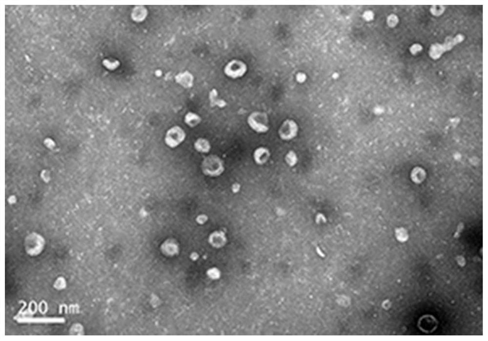 A method and kit for isolating high-purity urinary exosomes