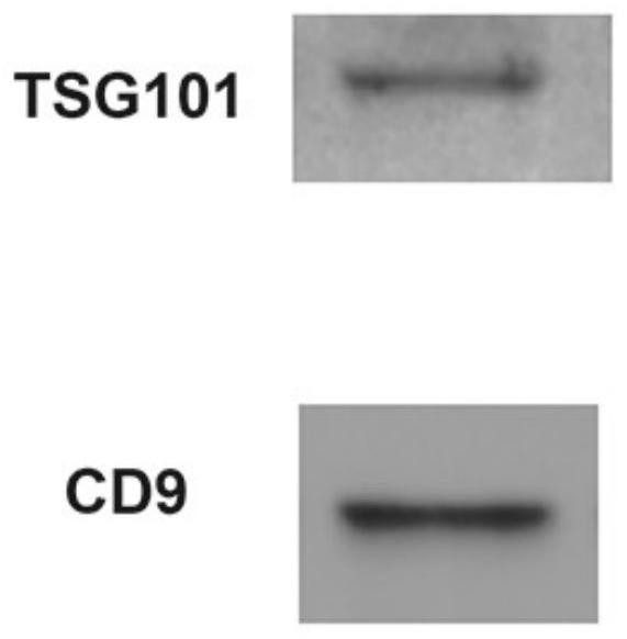 A method and kit for isolating high-purity urinary exosomes