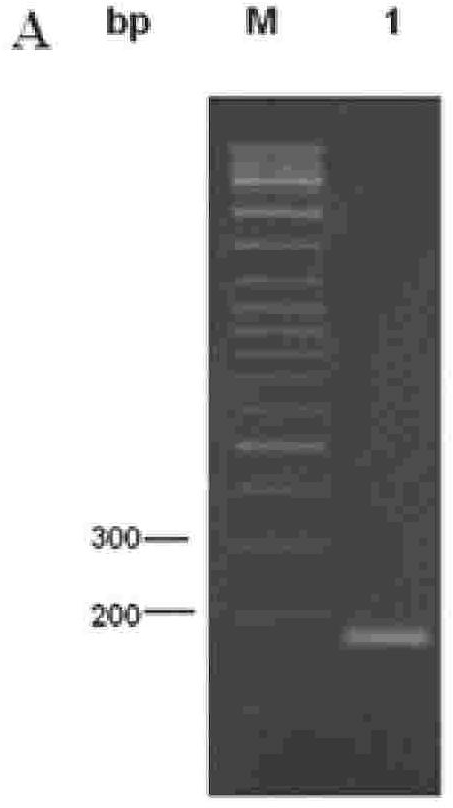 Recombinant human HNP gene liposome complex, preparation and use thereof