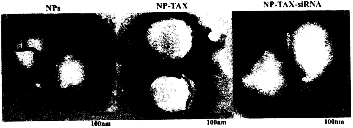 Preparation method of tumor targeted nanoparticle carrier co-loaded with breast cancer chemotherapeutic drug MTDH siRNA