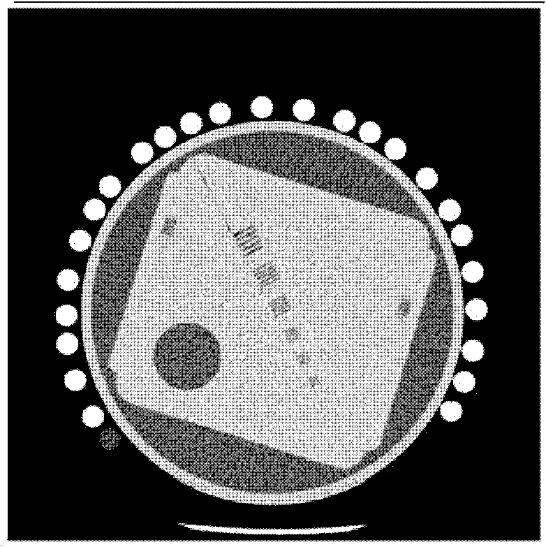 Method for reconstructing low-dose CT images based on redundant information of standard dose images