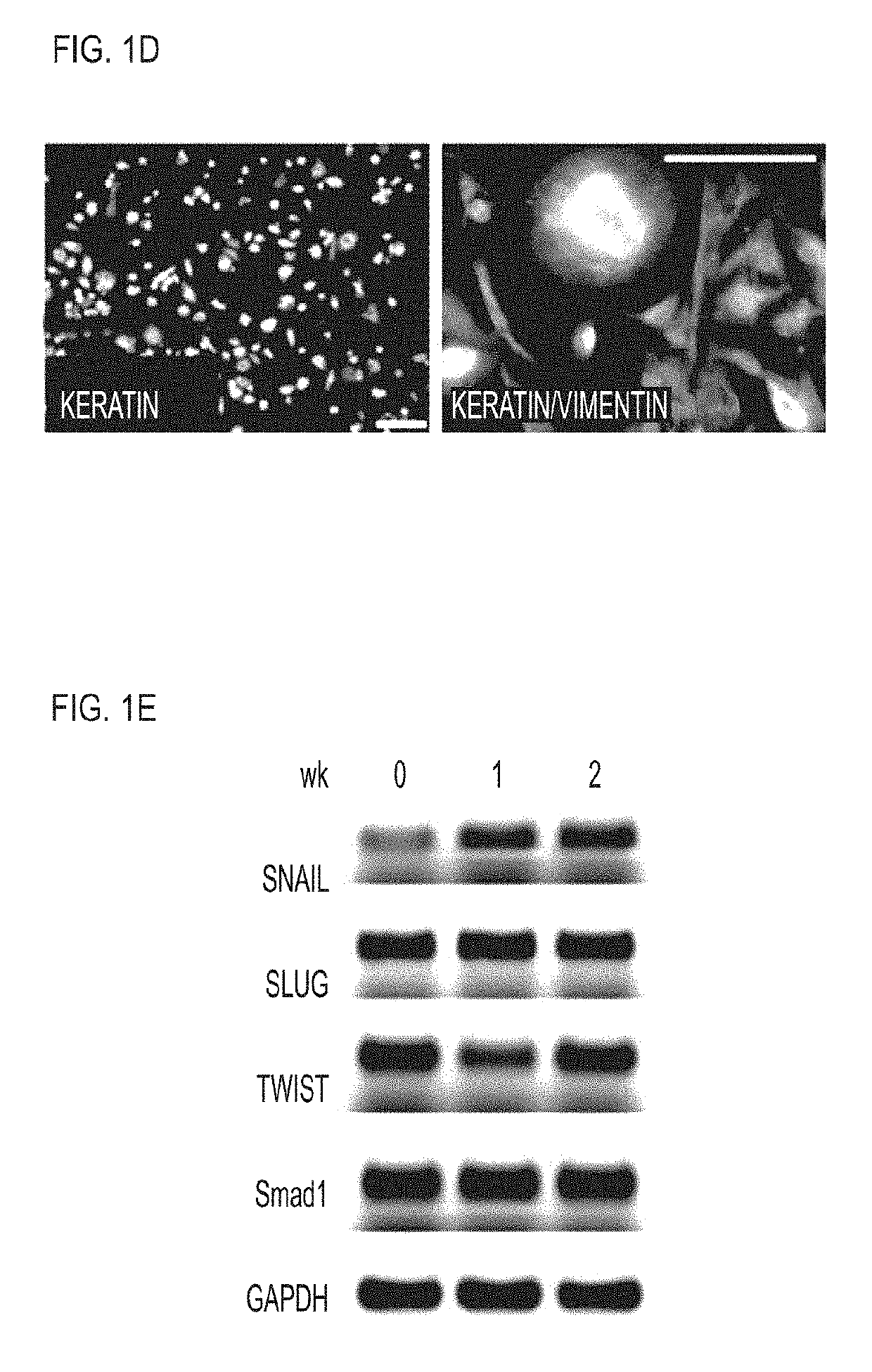 Compositions and Methods for Vascular Protection Against Reperfusion Injury After Myocardial Ischemia