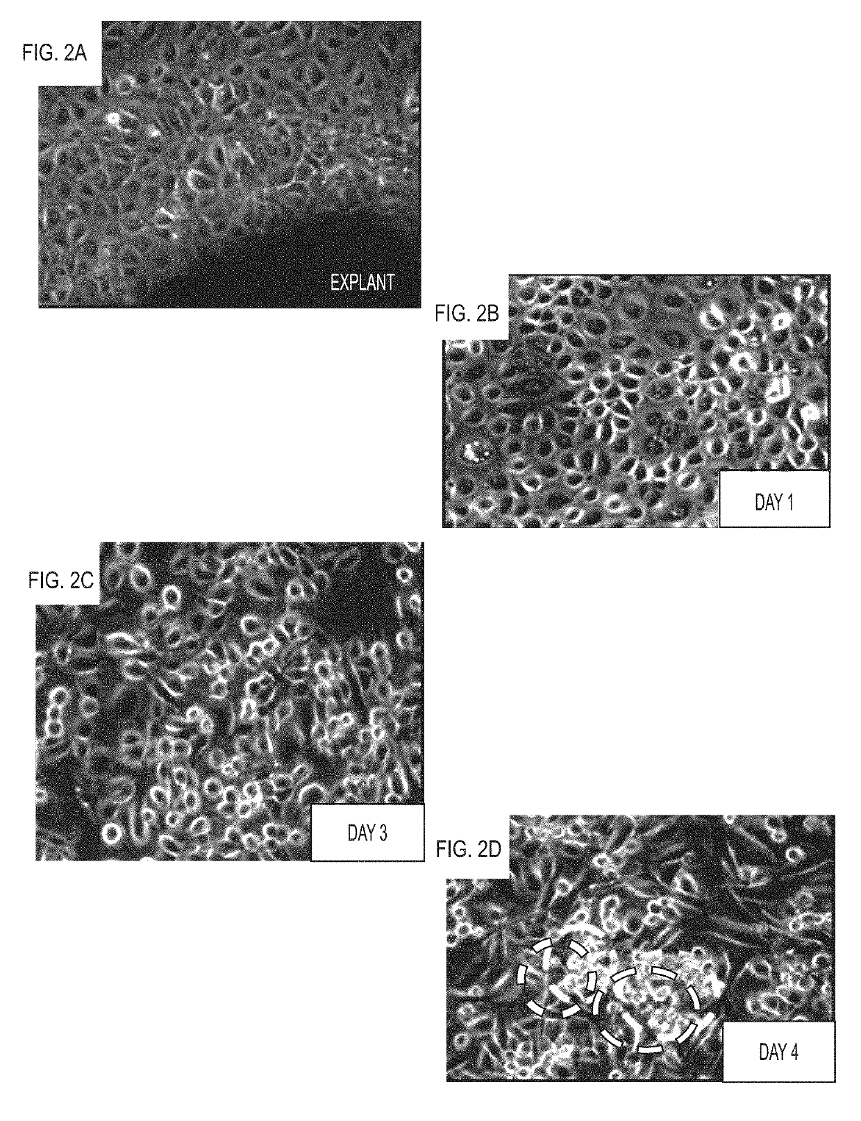 Compositions and Methods for Vascular Protection Against Reperfusion Injury After Myocardial Ischemia