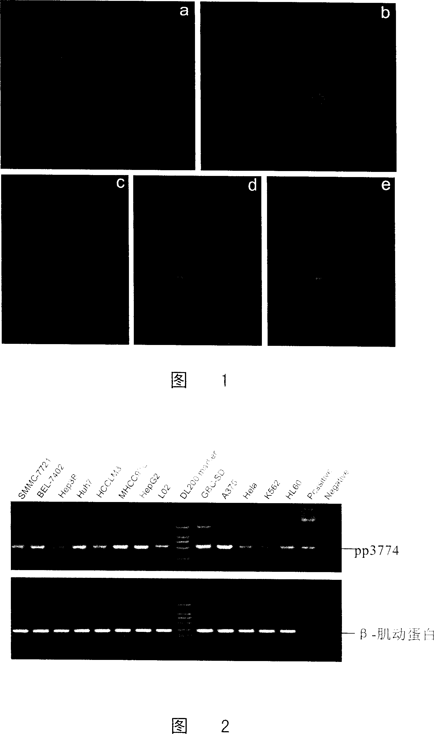 Use of pp3774 gene in inhibiting cell growth