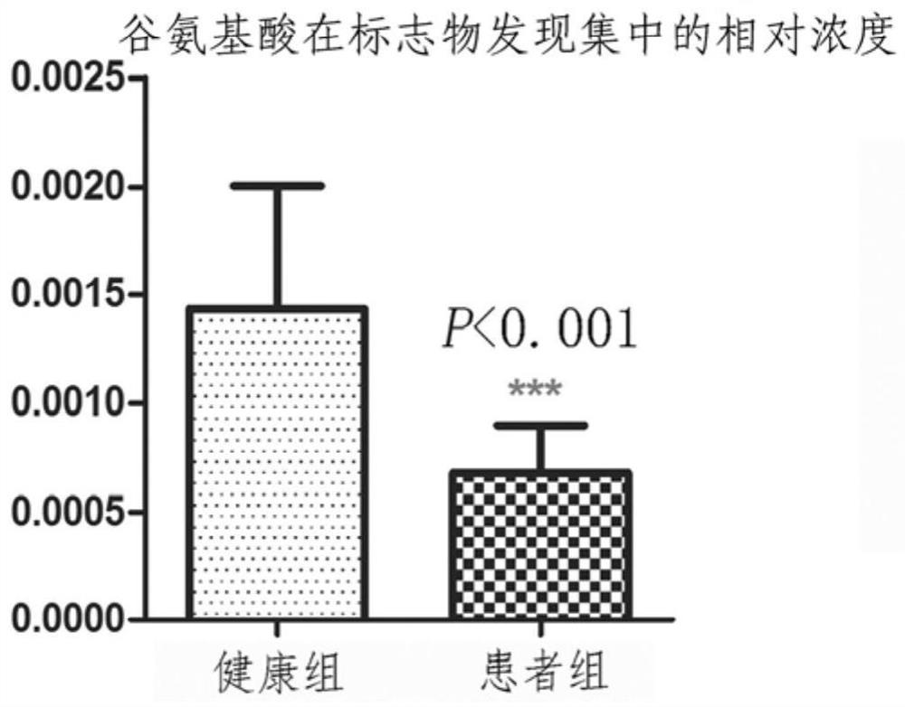 A method for establishing a diagnostic model of acute myeloid leukemia and its application