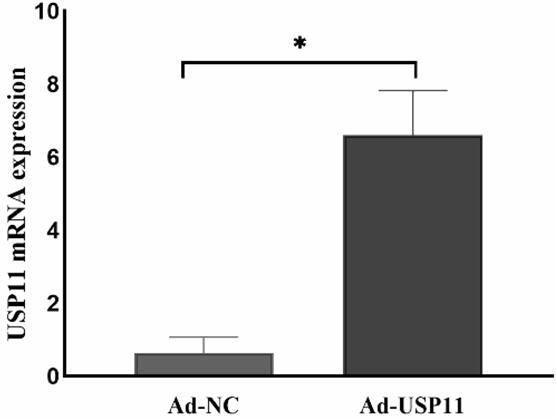 Application of USP11 in inhibition of degradation of cytokine IL6