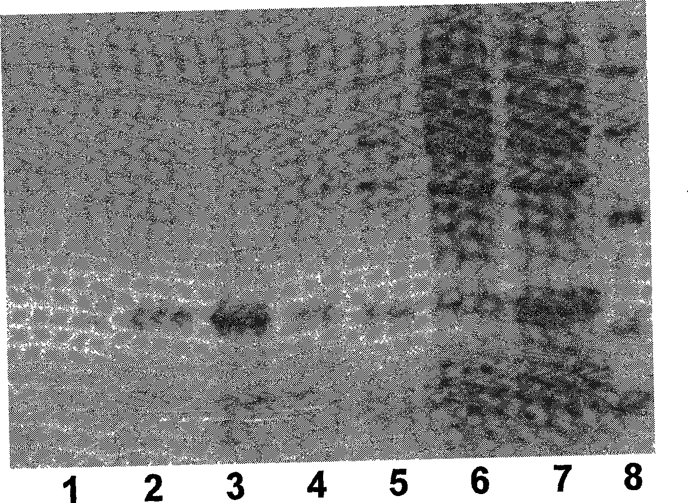 Method for preparing bitter melon polypeptide with function of reducing blood sugar bioactivity by gene engineering and application