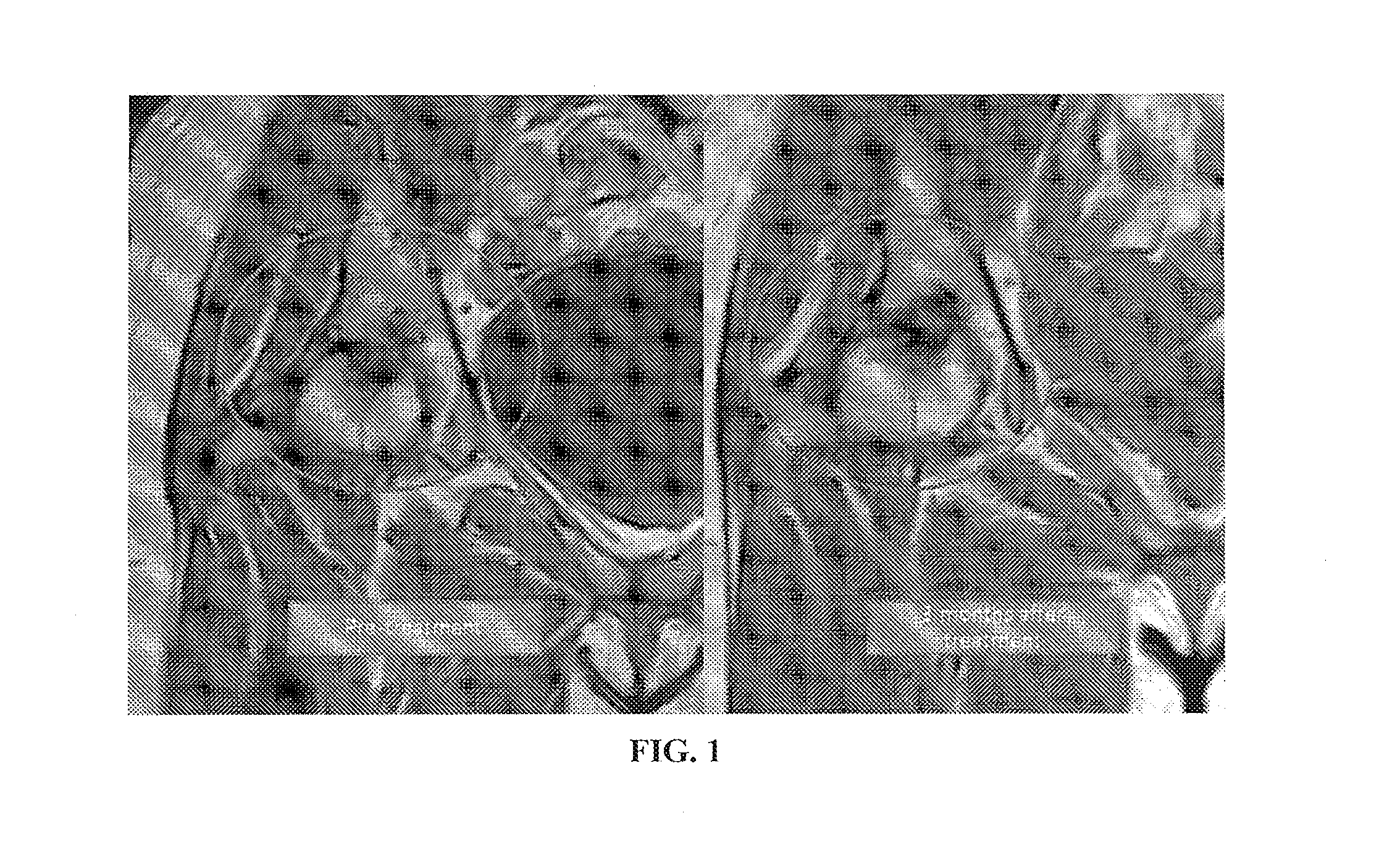 Methods and compositions for the treatment, prevention, and alleviation of bone and cartilage diseases or injuries and hair loss