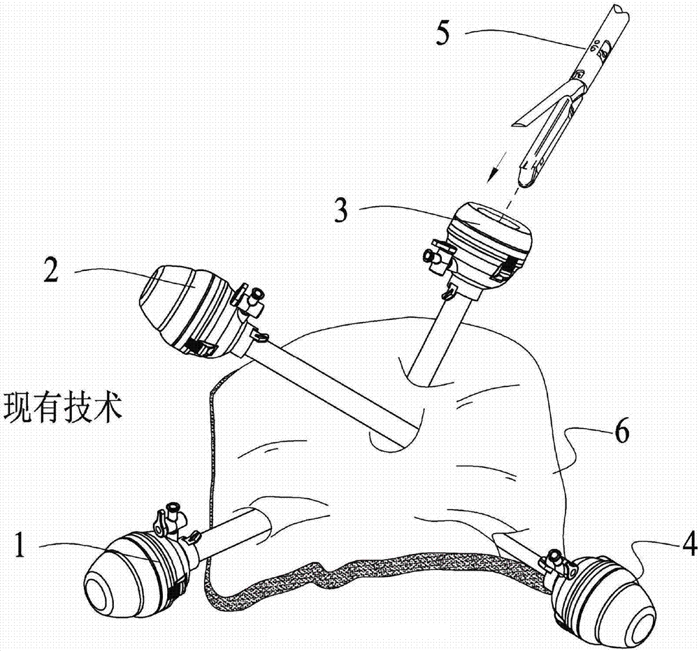 Chuck type diameter-variable cannula device and puncture device