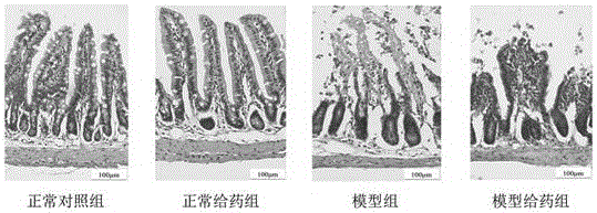 Application of miR-665-3p inhibitor to preparation of medicine for preventing and treating ischemia-reperfusion injuries