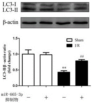 Application of miR-665-3p inhibitor to preparation of medicine for preventing and treating ischemia-reperfusion injuries