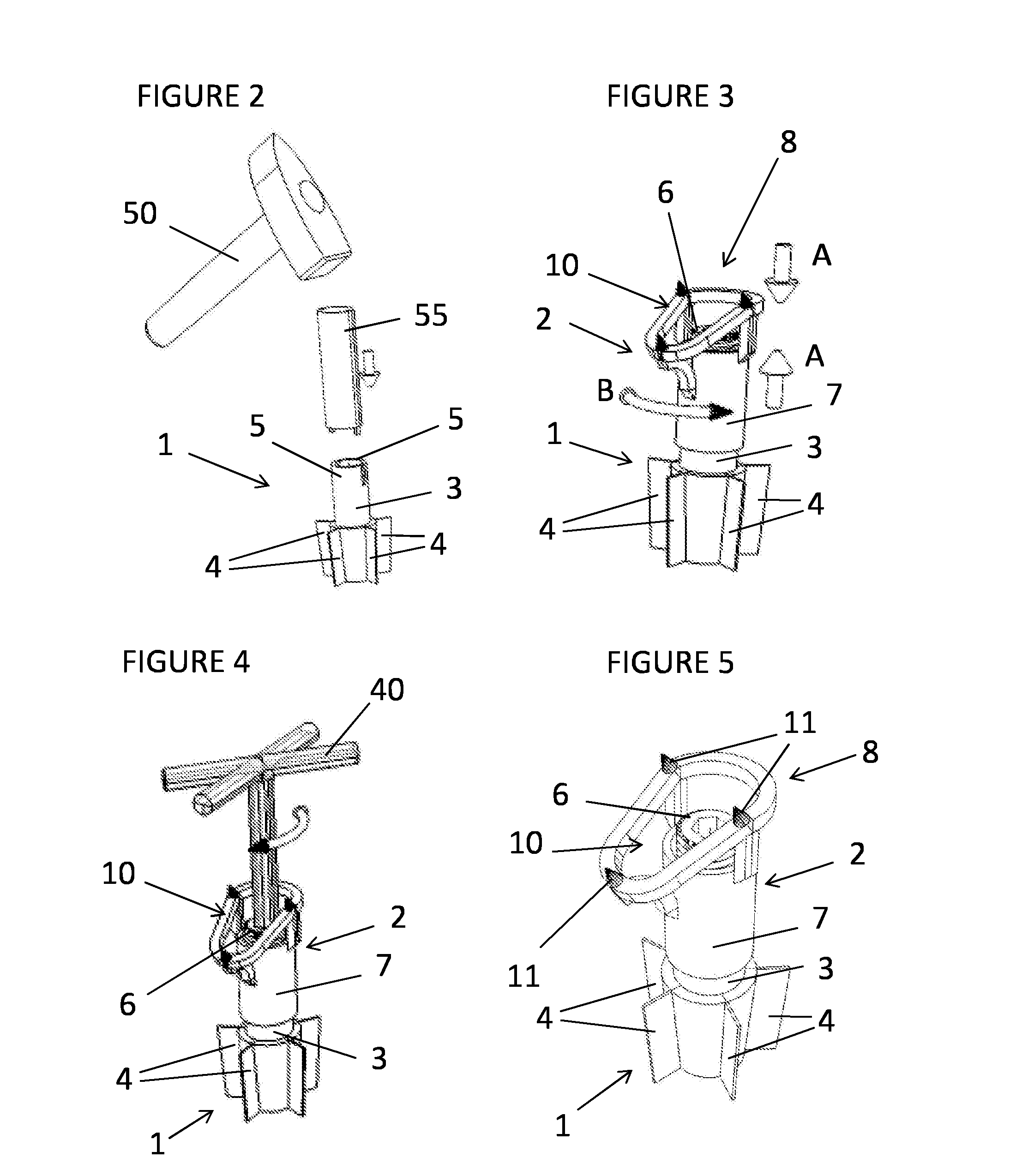 A medical device for reconstruction of a humerus for the operative treatment of a proximal humerus fracture