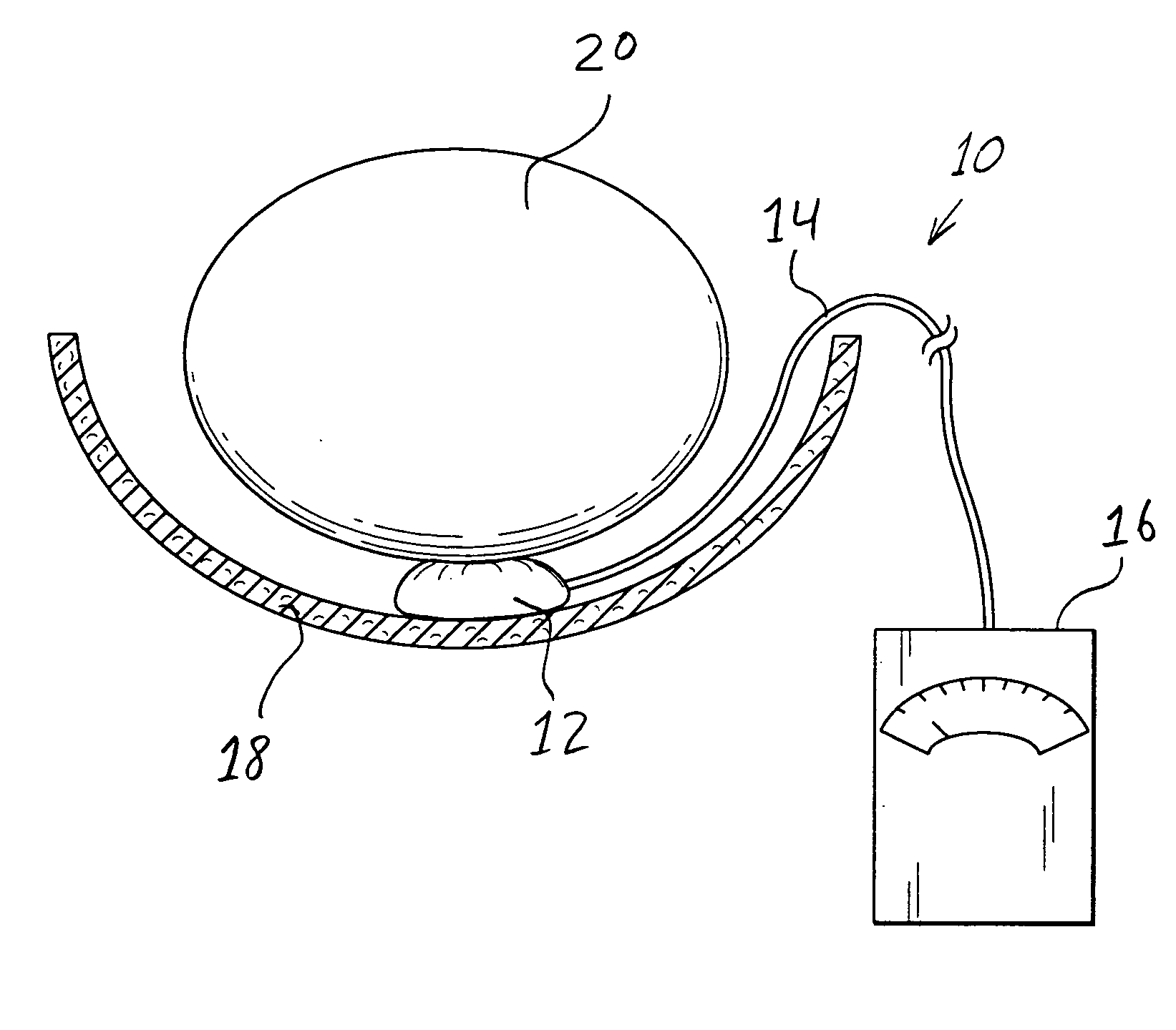 Systems and methods for determining pressure and spacing relating to anatomical structures