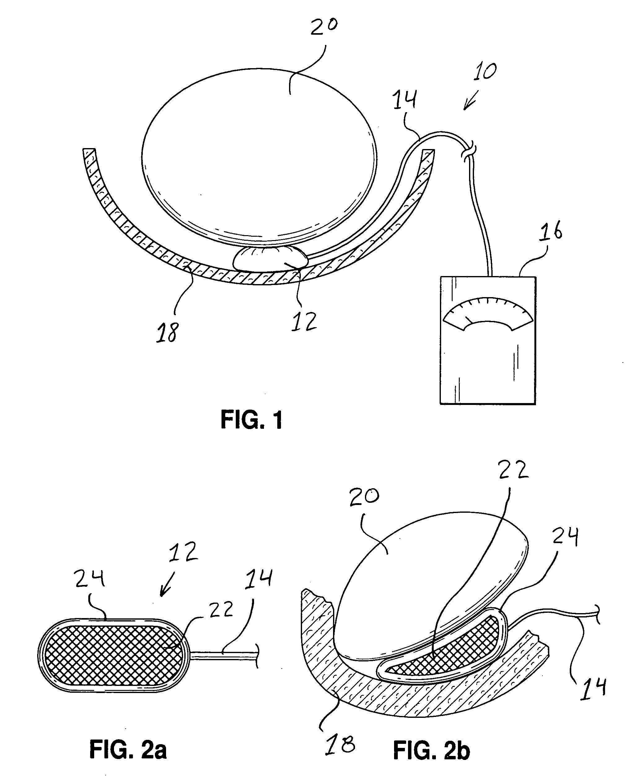 Systems and methods for determining pressure and spacing relating to anatomical structures