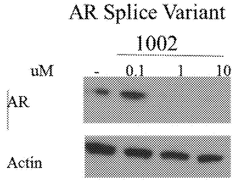 Selective androgen receptor degrader (SARD) ligands and methods of use thereof