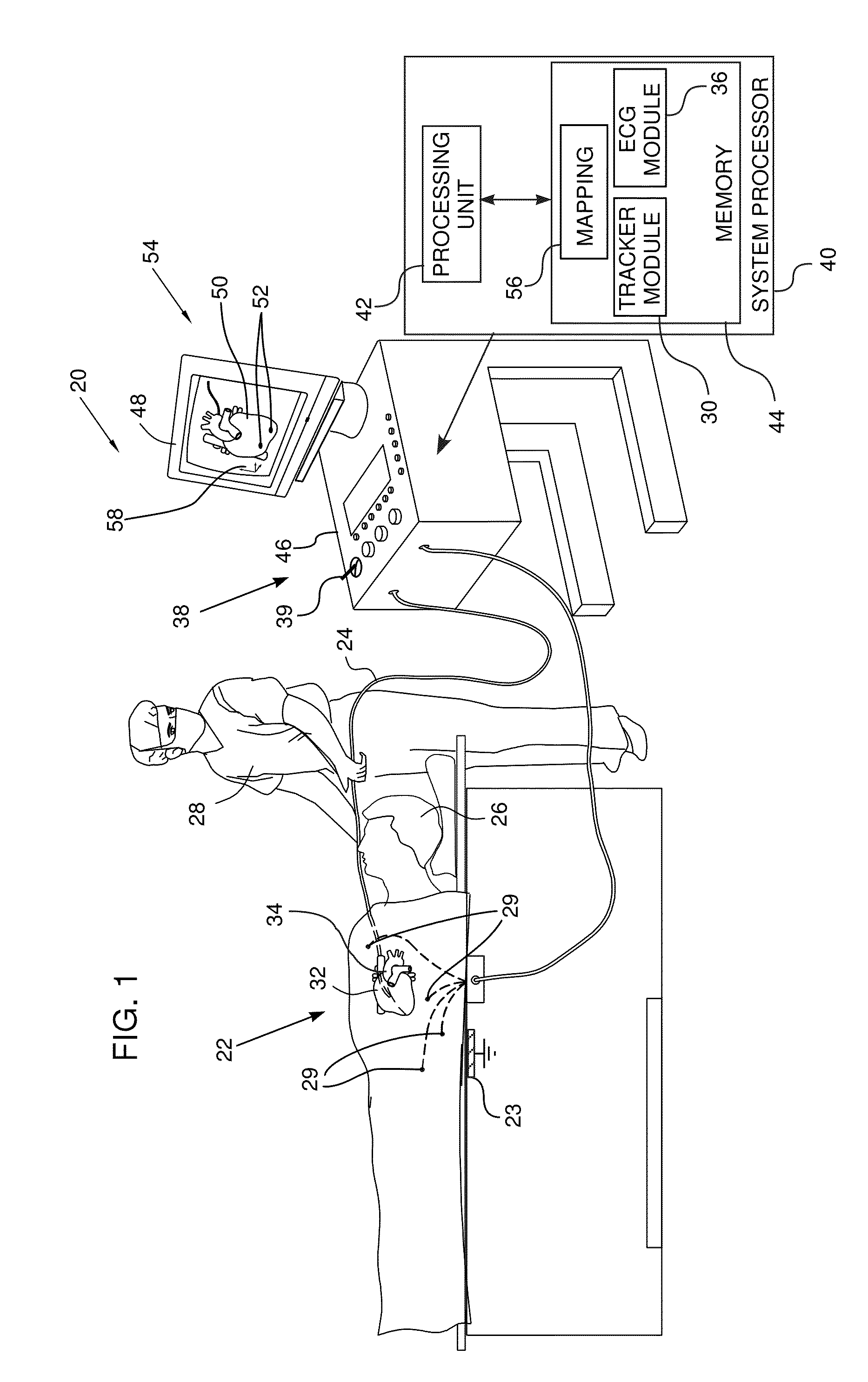 Selectably transparent electrophysiology map