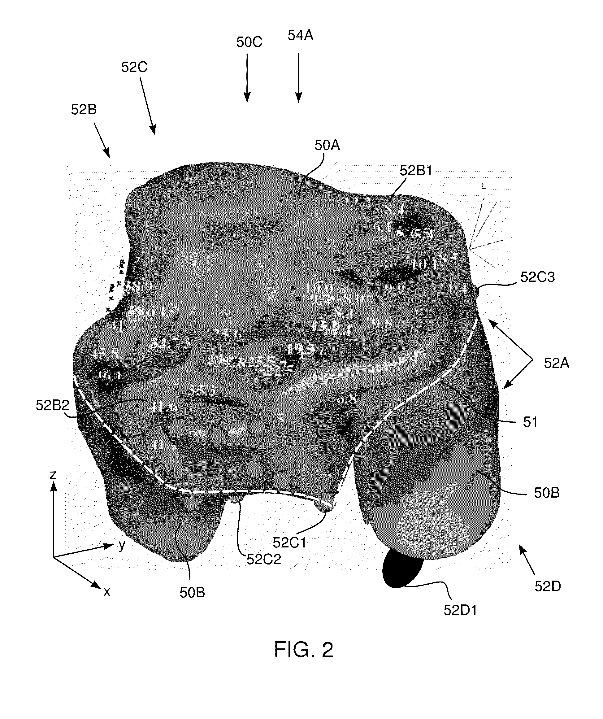 Selectably transparent electrophysiology map