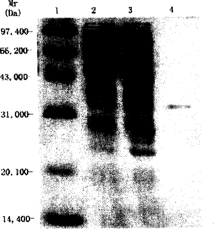 Variable region of light chain and heavy chain genes of anti-KDR monoclonal antibody and its use