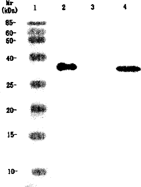 Variable region of light chain and heavy chain genes of anti-KDR monoclonal antibody and its use