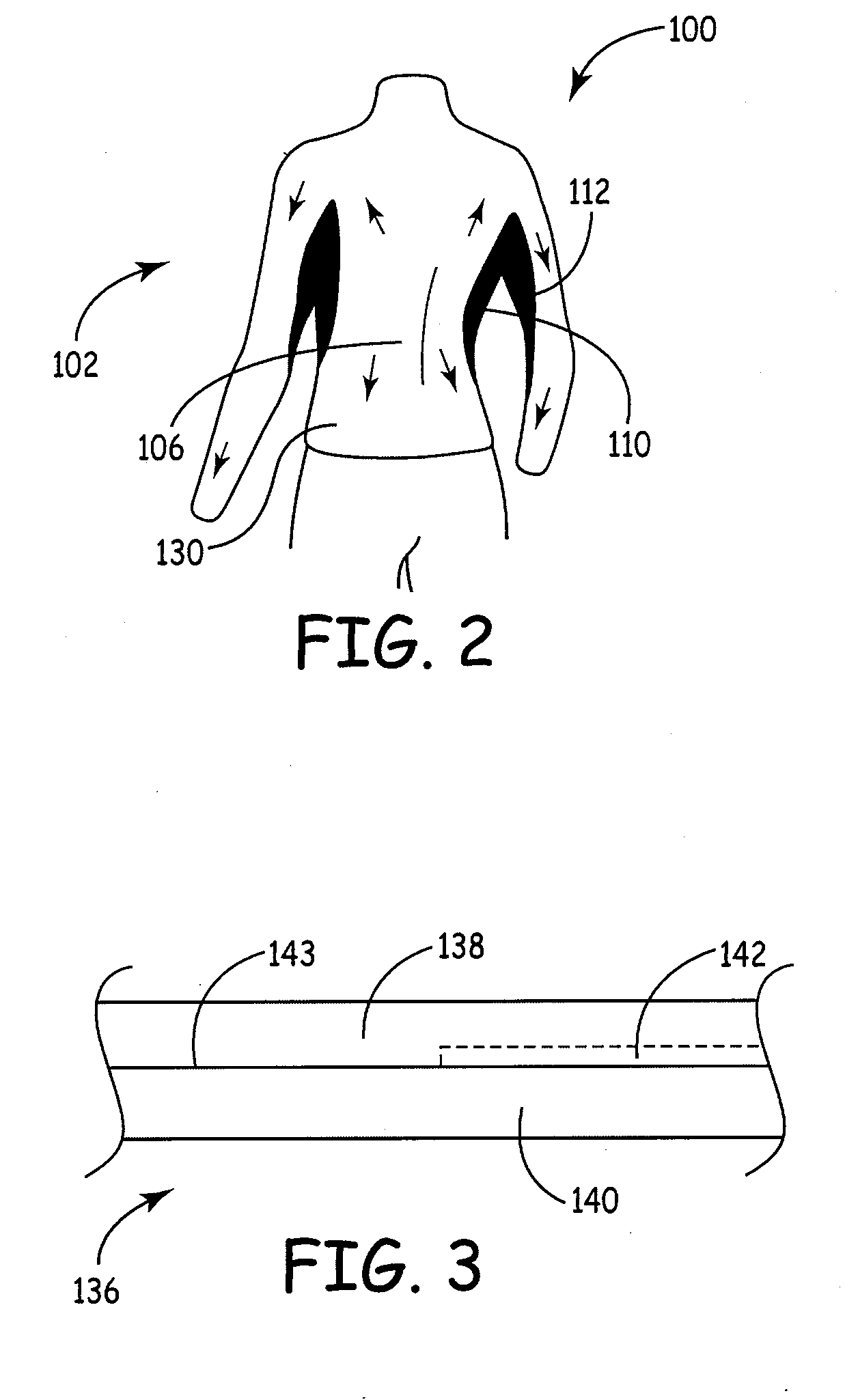 Apparel item for compressive treatment of edema