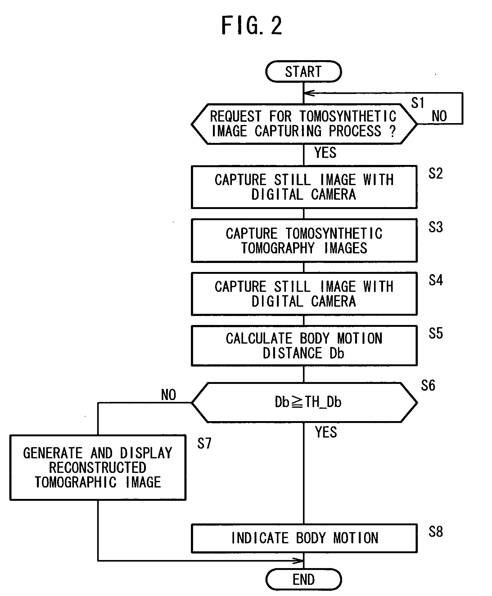 Radiographic tomography apparatus