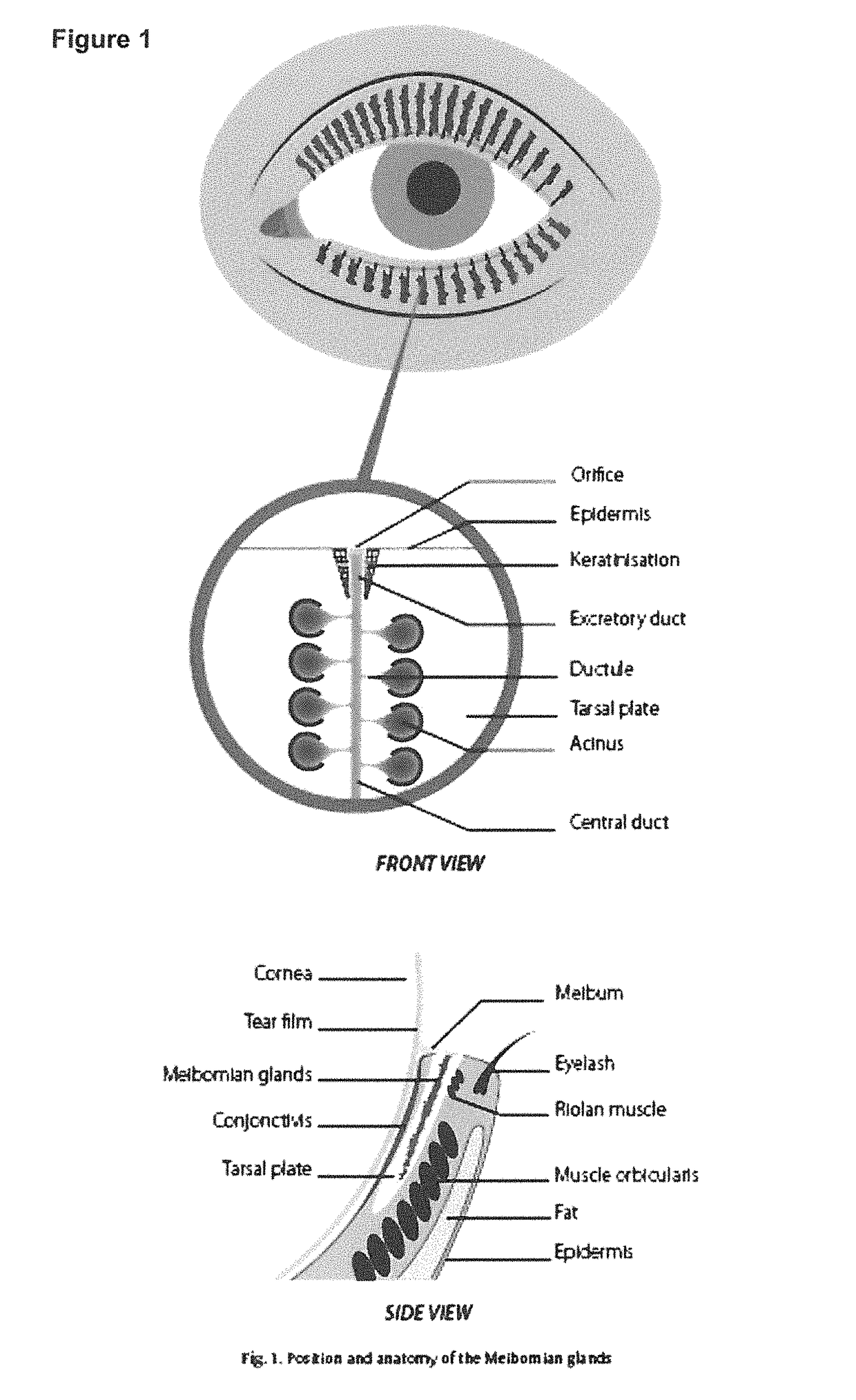 Eye massage device