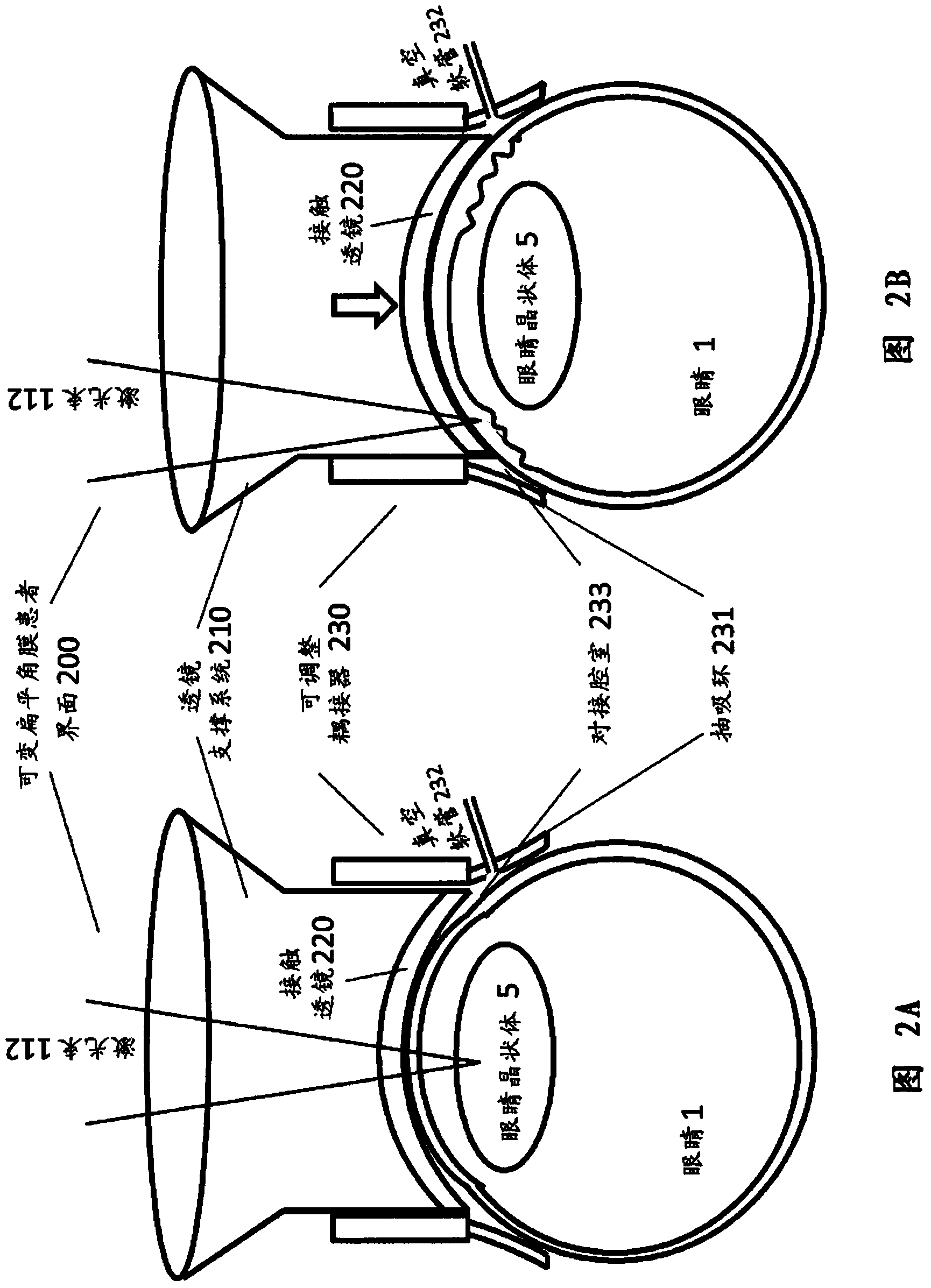 Patient interface with variable applanation