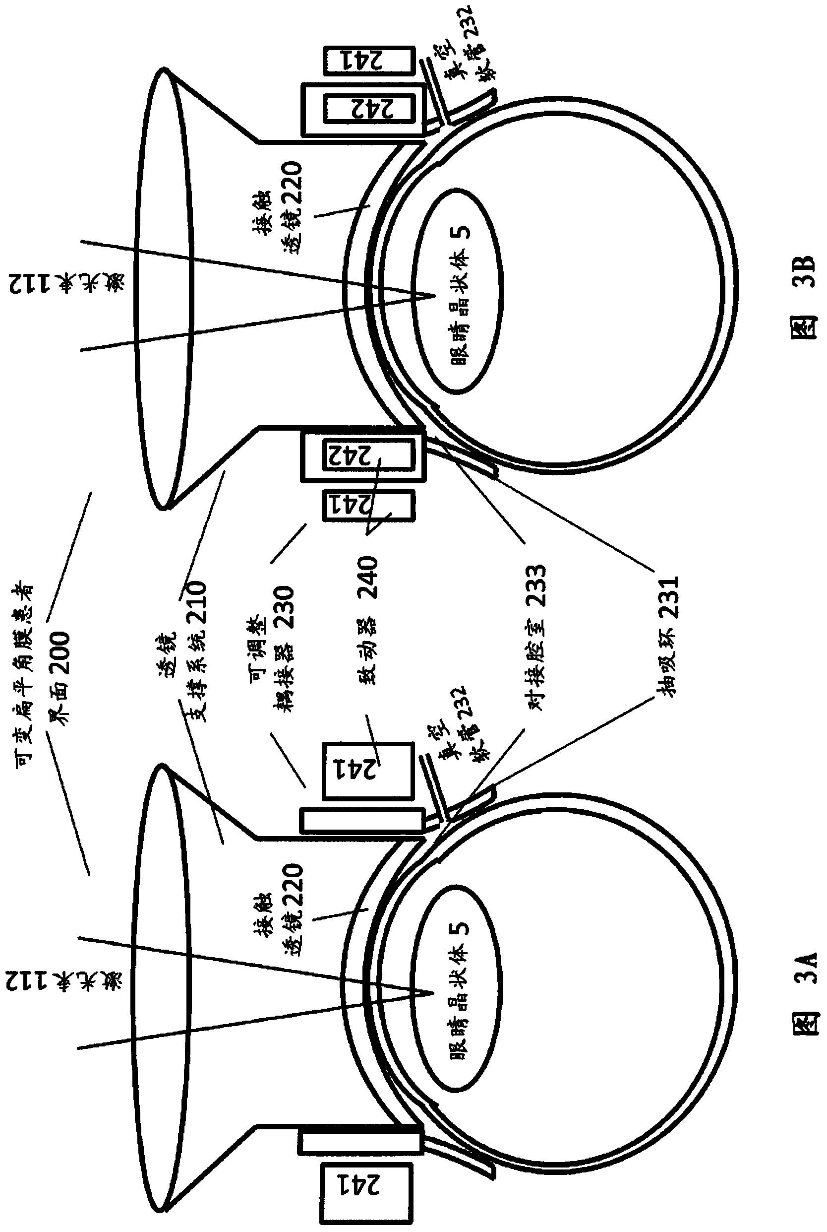 Patient interface with variable applanation