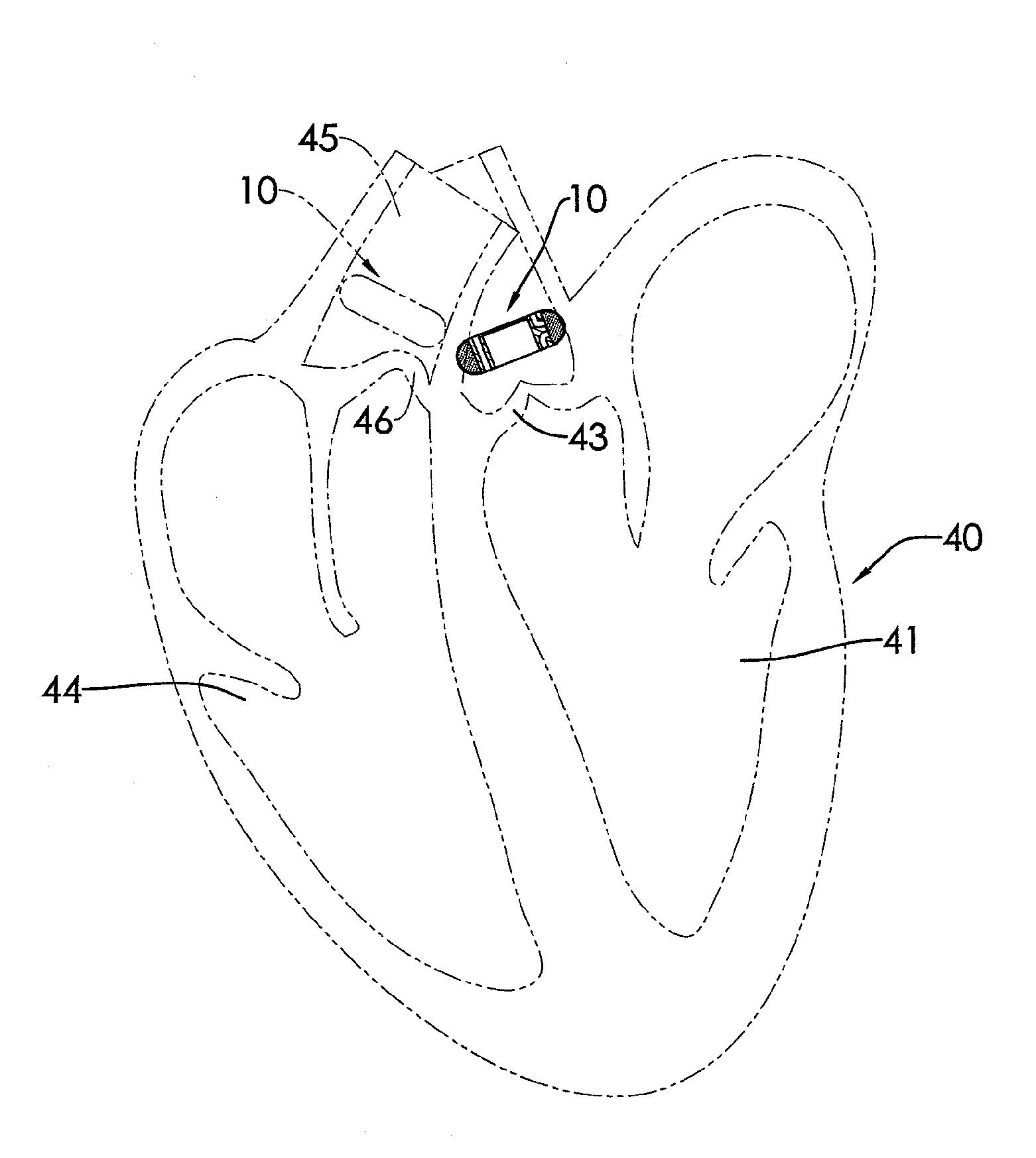 Examining device for examining an aortic valve and a pulmonary valve competency