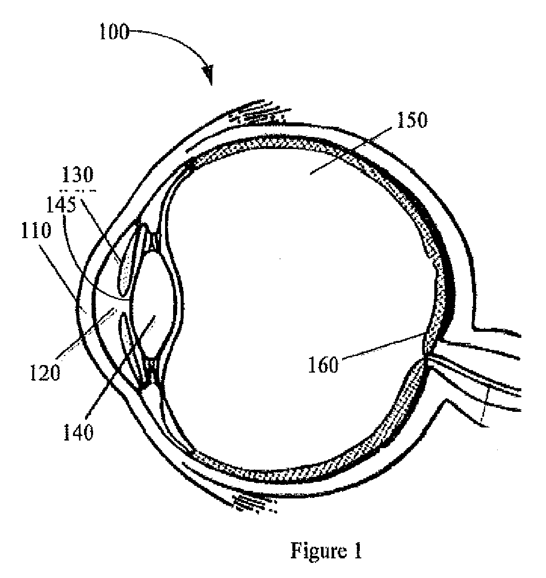 Micro-incision IOL and positioning of the IOL in the eye