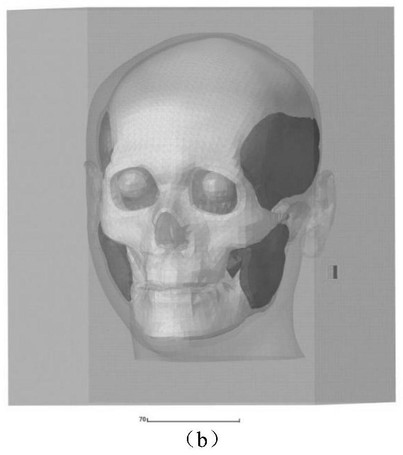 Human maxillofacial region explosion injury simulation and biomechanical simulation method, system and medium