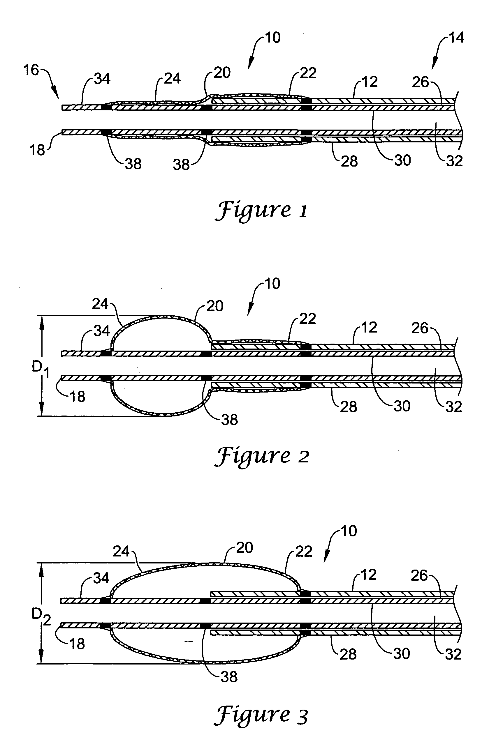 Occlusion balloon catheter with longitudinally expandable balloon