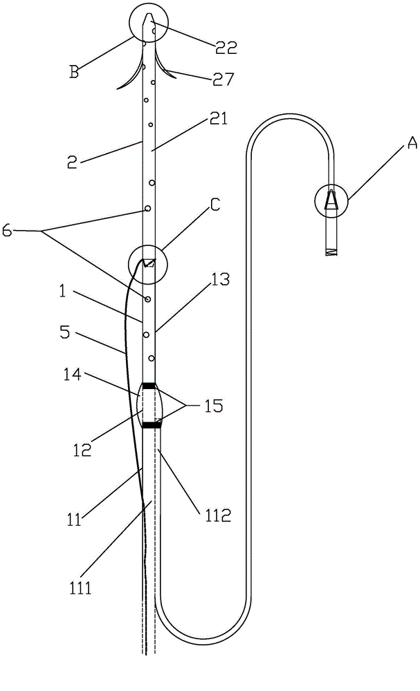 Integrated bile and pancreatic juice drainage pipe