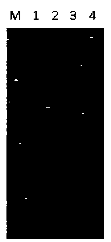 Detection reagent kit and detection method of aeromonas bacteria