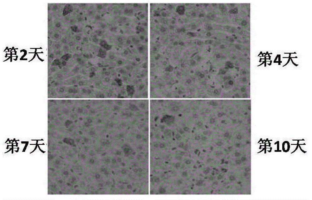 Application of substance for inhibiting LSECtin in preparing medicine for treating and/or preventing viral hepatitis B