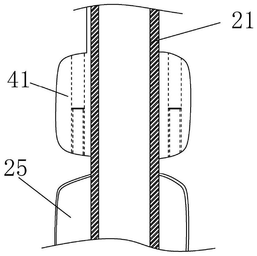 A voice training rehabilitation device after tracheotomy