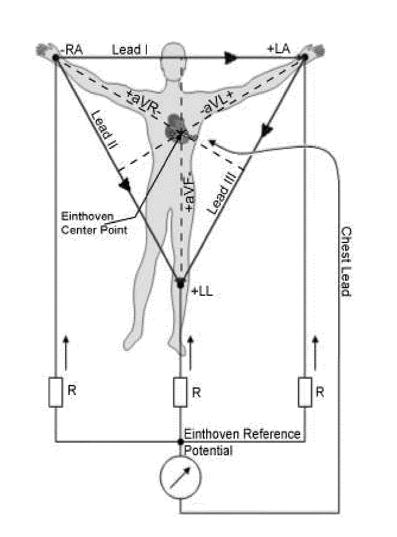 ECG device with impulse and channel switching ADC noise filter and error corrector for derived leads