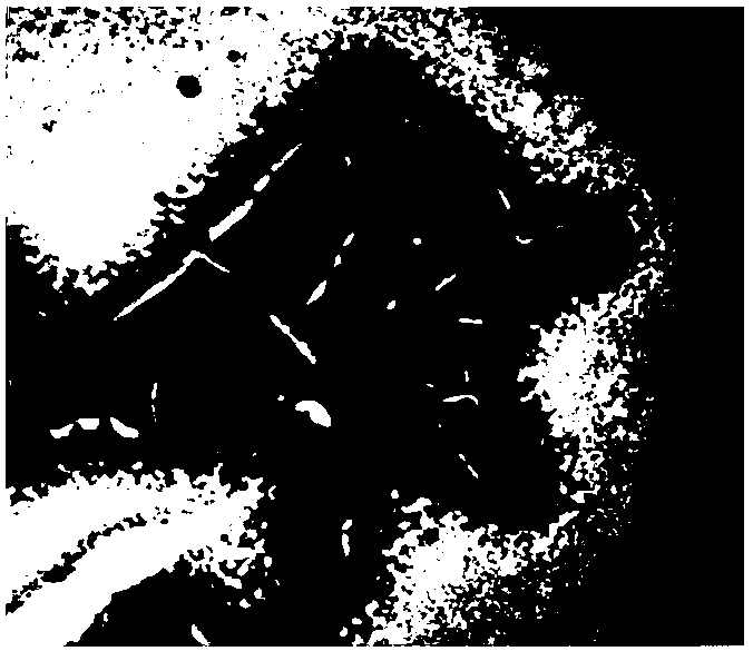 Phthalic acid di(2-ethyl) hexyl ester degrading bacterium as well as culture method and application thereof