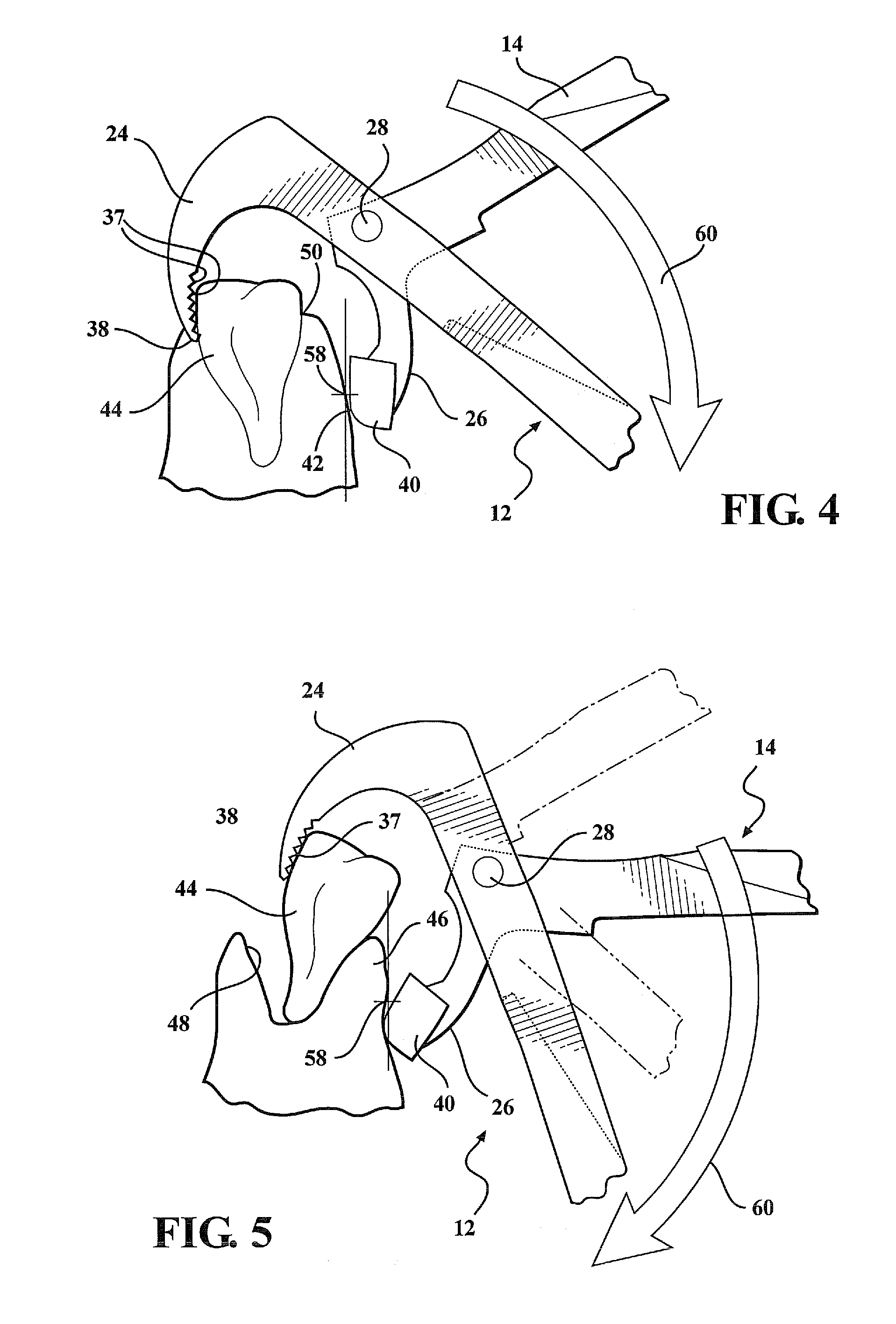 Dental plier design with offsetting jaw and pad elements for assisting in removing upper and lower teeth utilizing the dental plier design