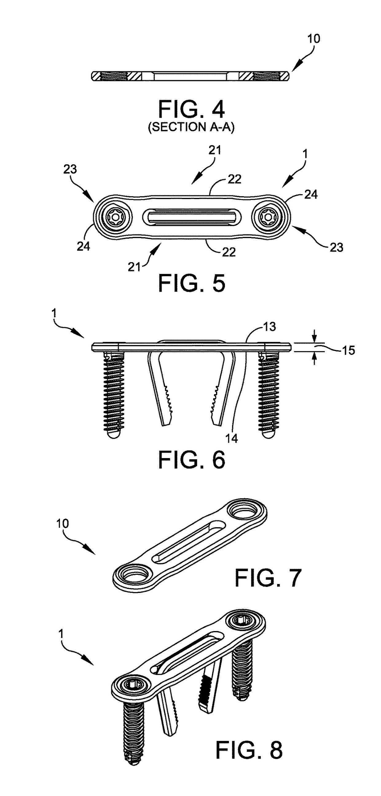 Active compression plate and method for its use