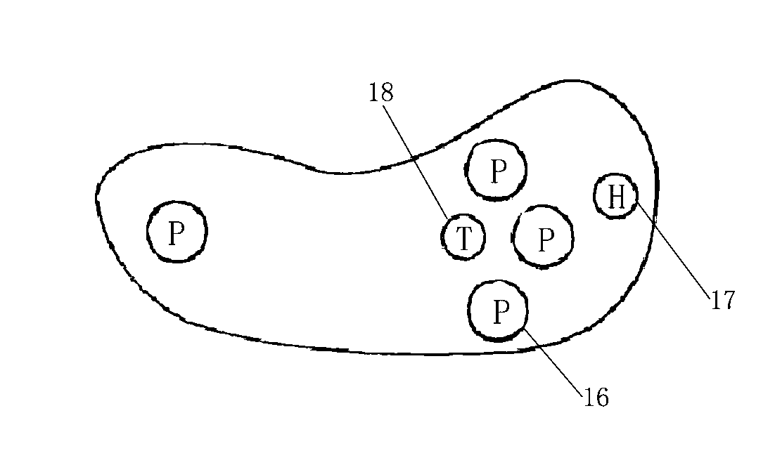 Plantar pressure distribution measuring system