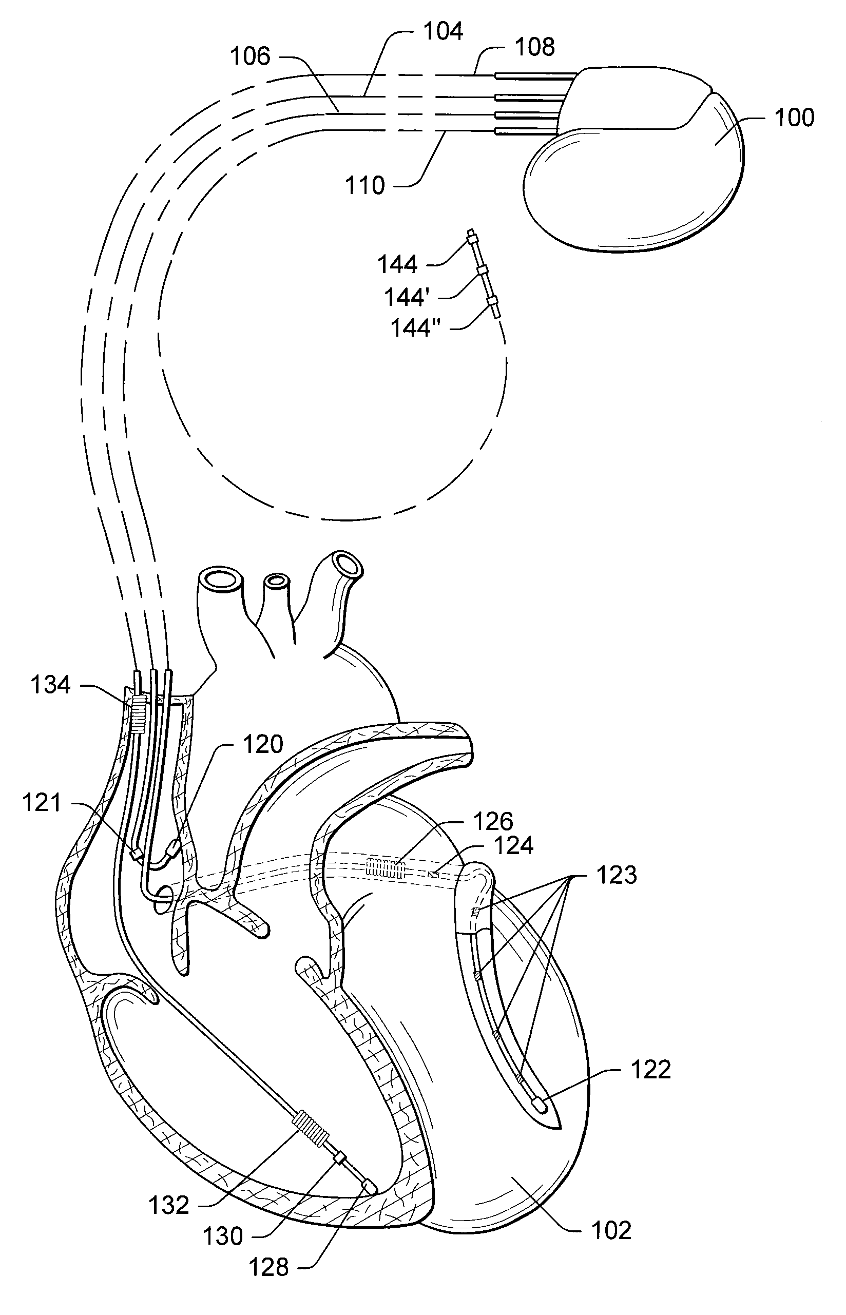 Electrode and lead stability indexes and stability maps based on localization system data