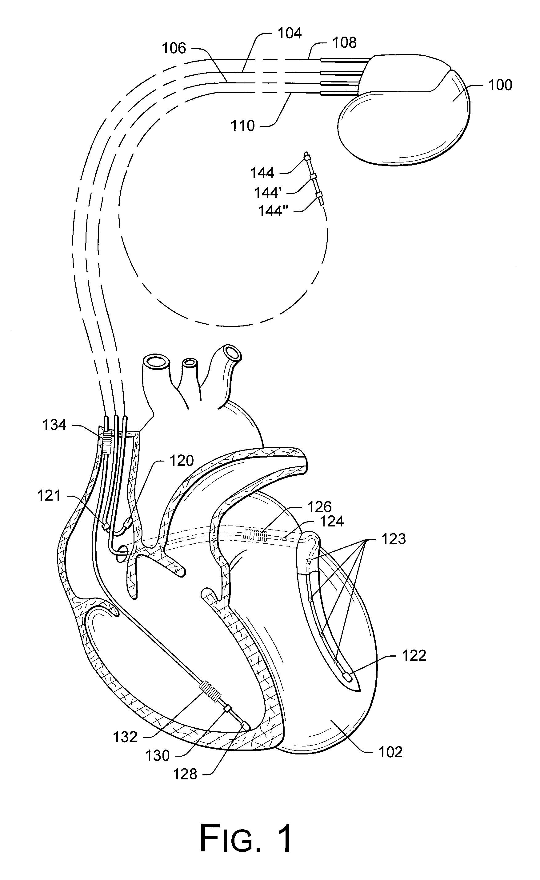 Electrode and lead stability indexes and stability maps based on localization system data