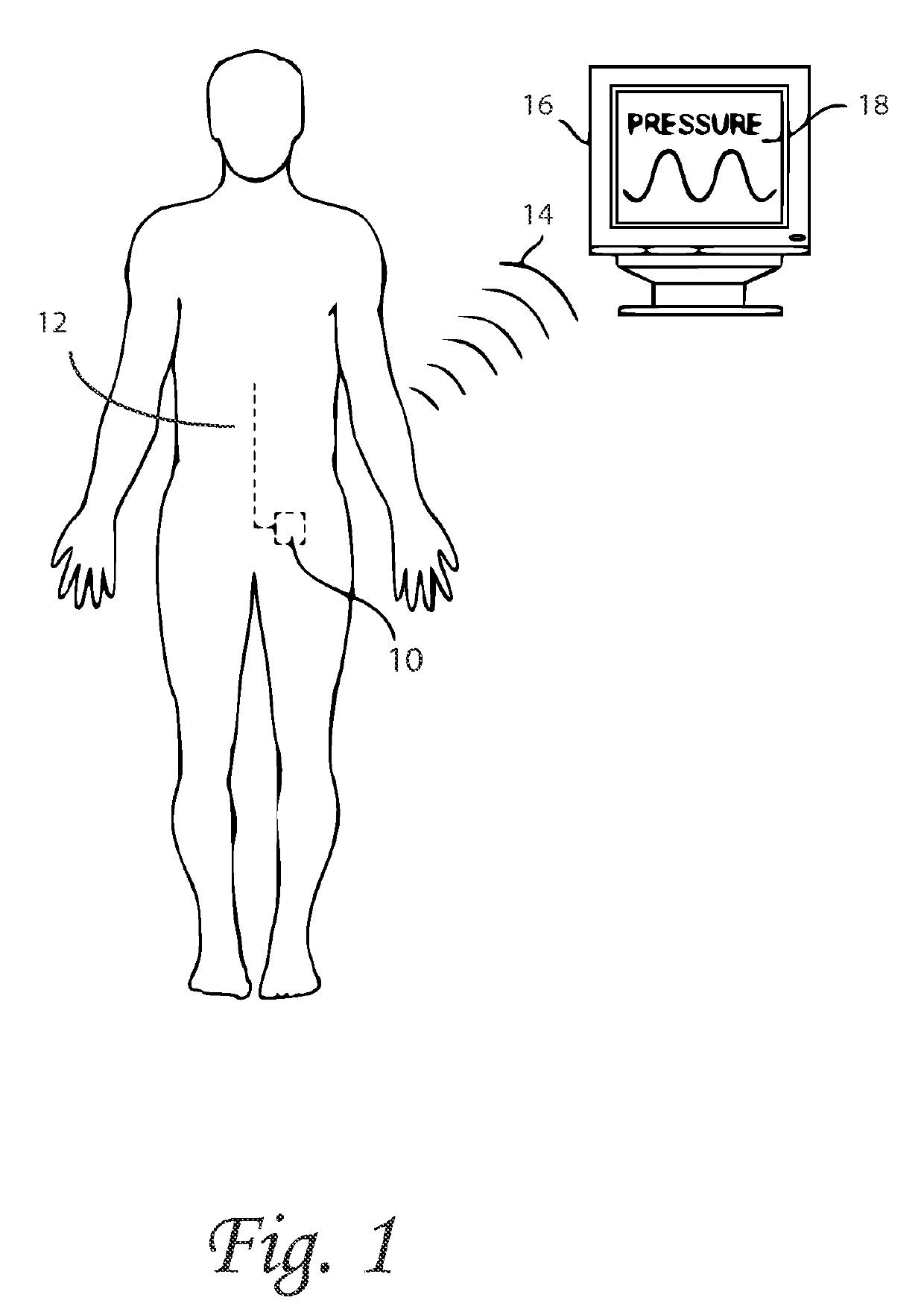 Systems and methods for lumbar cerebrospinal fluid access and treatment