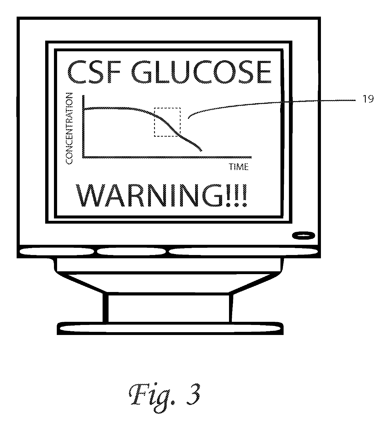 Systems and methods for lumbar cerebrospinal fluid access and treatment