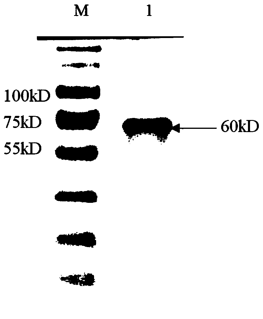 Anti-Mullerhormone latex enhanced turbidimetry detection kit, and preparation and application method thereof