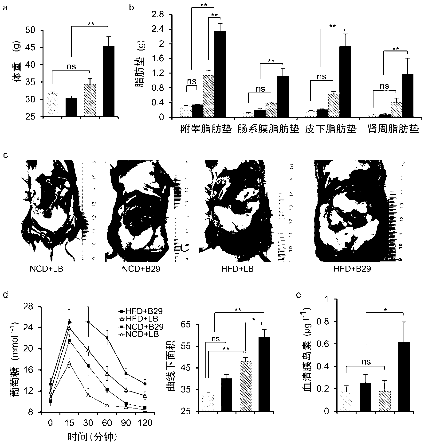 Method of establishing gnotobiotic animal obesity model and application of model